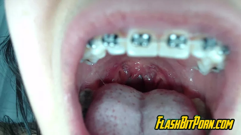 mia_isabella3 - Braces, mouth, uvula fetish